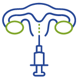 Intrauterine Insemination (IUI)